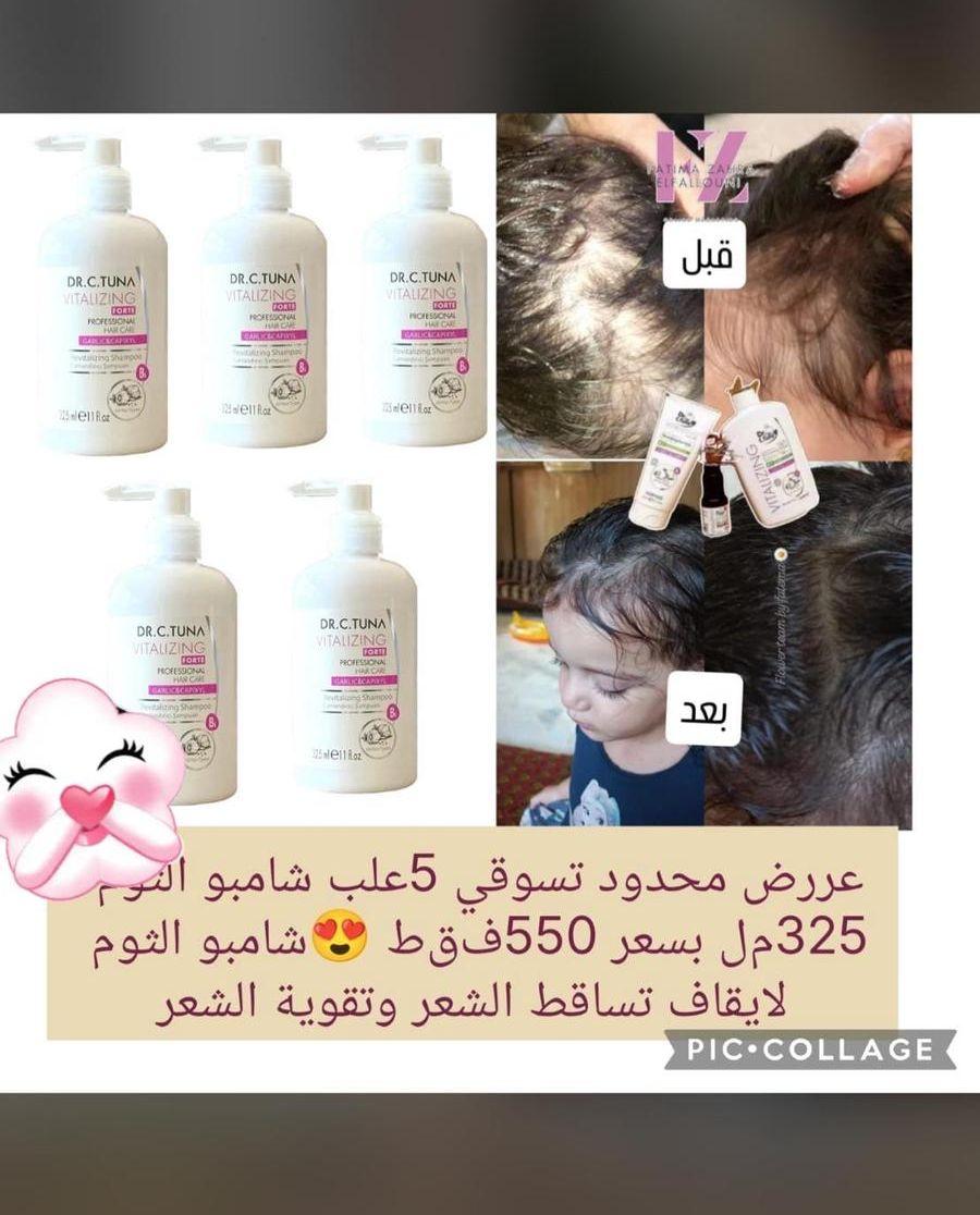 كبسولات تنحيف