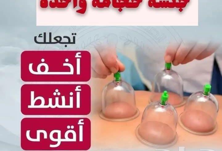 الحجامه راحه